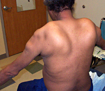 FACIOSCAPULOHUMERAL MUSCULAR DYSTROPHY: Internationally & Instantly Healed – $30,000,000 to Lululemon DIRECT&nbsp;DEPOSIT